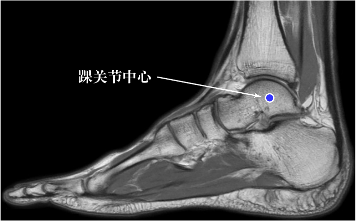 迈克杰克逊简介（迈克尔·杰克逊 45 度前倾是怎么做到的？）