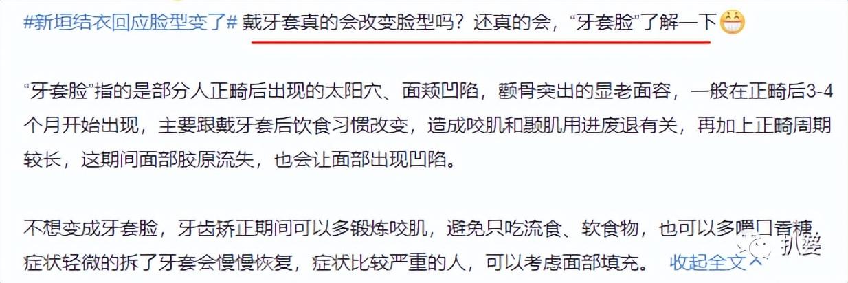 新恒结衣是谁（新垣结衣好惨，才33岁就被骂“老阿姨”了）